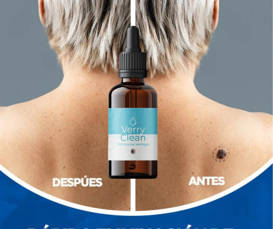 💥 Despídete de las Verrugas Hoy