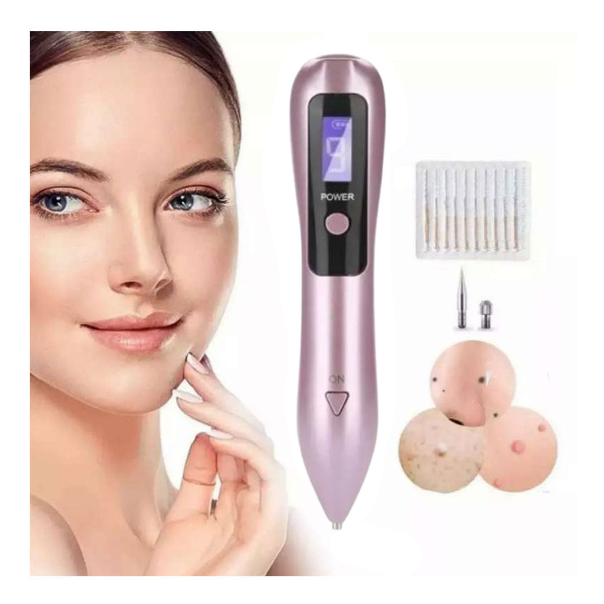 Cauterizador Suizo – Removedor de Verrugas y Lunares