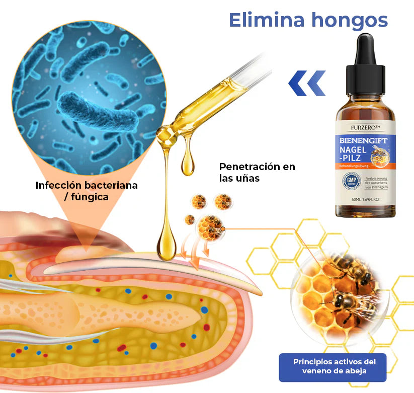 MyCare® |ELIMINA LOS HONGOS DE LAS UÑAS EN 5 DÍAS Y EVITA QUE APEREZCAN PARA SIEMPRE