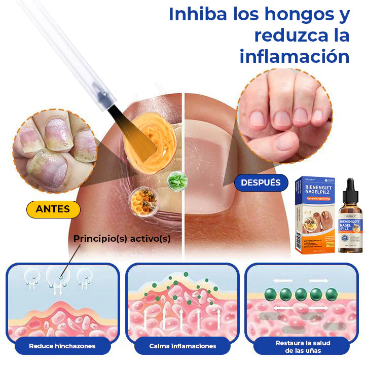 MyCare® |ELIMINA LOS HONGOS DE LAS UÑAS EN 5 DÍAS Y EVITA QUE APEREZCAN PARA SIEMPRE